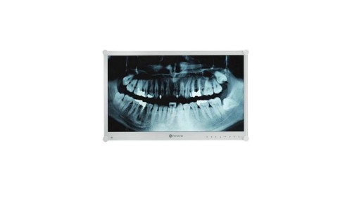 Monitor medyczny LED 24” Full HD z hartowanym szkłem optycznym, podświetlenie klisz RTG, do pracy 24/7 DR-24G