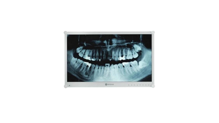 Monitor medyczny LED 24” Full HD z hartowanym szkłem optycznym, podświetlenie klisz RTG, do pracy 24/7 DR-24G